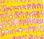 jérôme noetinger - dr jérôme noetinger - dr