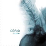 ulna - frcture ulna - frcture