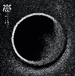 202 project - total éclipse 202 project - total éclipse