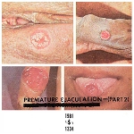 premature ejaculation (rozz williams) - part 2 premature ejaculation (rozz williams) - part 2